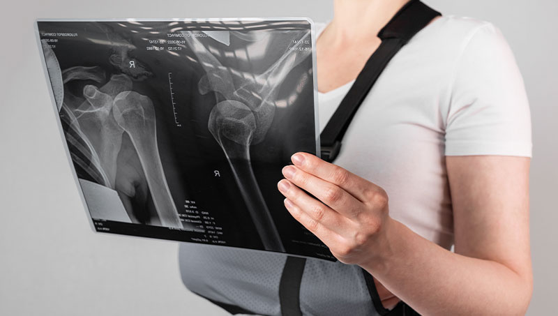shoulder pain after car accident in Ontario